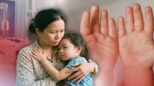 Ba bệnh rình rập trẻ nhỏ mùa nắng