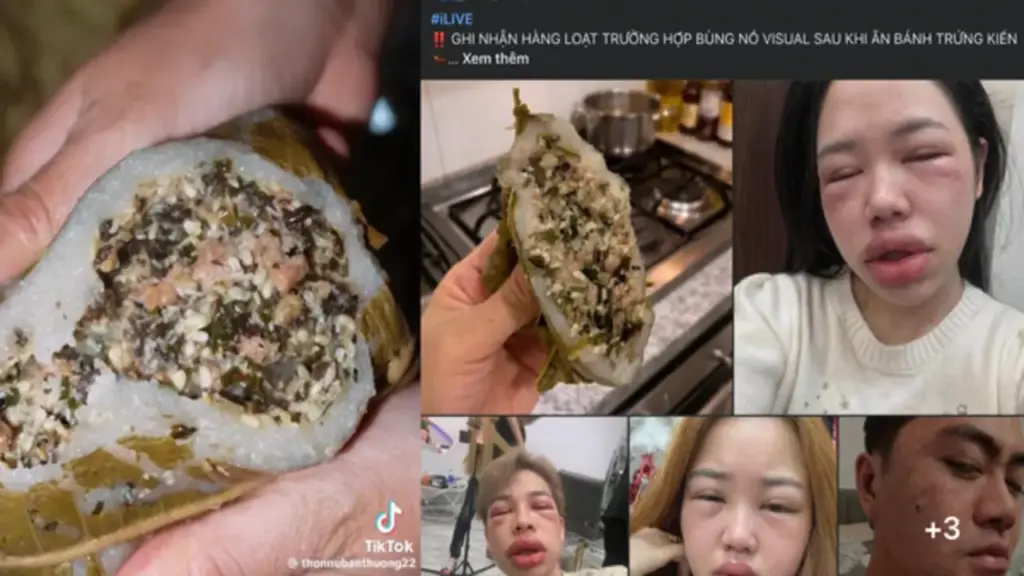 Bánh trứng kiến đang 'hot' mạng: Có người phải nhập viện vì dị ứng, ai cần tránh?