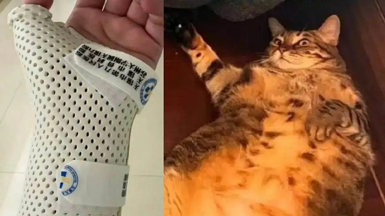 Bị mèo nặng 7,5 kg 'đè' khi ngủ, cô gái gãy xương cổ tay
