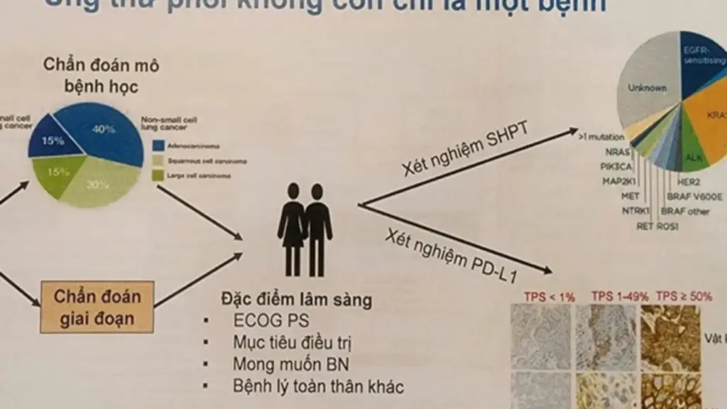 Coi chừng nhầm tưởng ung thư phổi với bệnh hô hấp