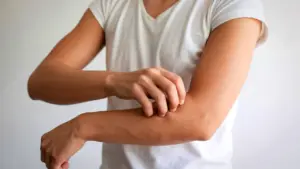 Ngứa da râm ran về đêm - dấu hiệu suy thận dễ bị bỏ qua