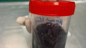 Phổi nạn nhân vụ cháy nhà ở Hà Nội bám đầy khói bụi, muội than