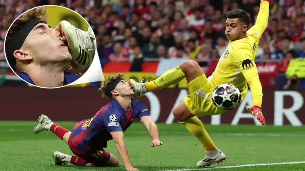 Tiền vệ Barca đổ máu sau khi bị đá vào mặt